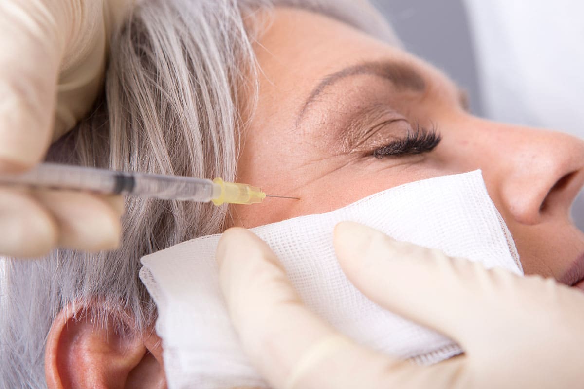 Botox Injektion gegen Falten bei den Augen durch Dr. Zuzana Bauer bei Aestomed in Wien