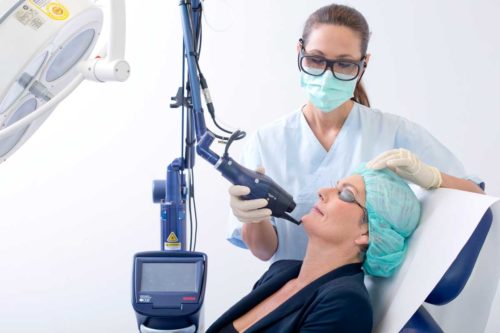 Faltenbehandlung mit Laser im Gesicht einer Frau durch Dr. Bauer bei Aestomed Wien