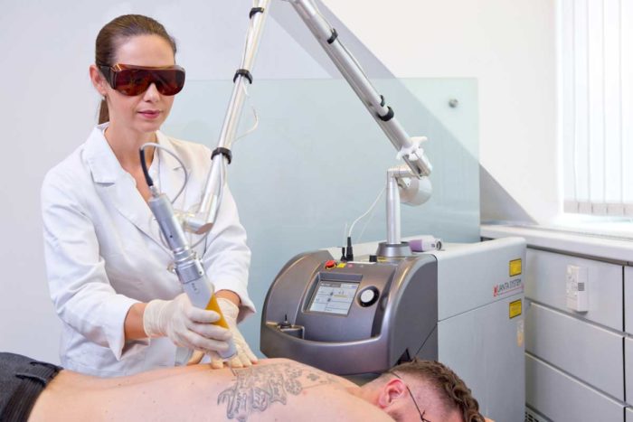 Tattooentfernung mit Laser am Rücken eines Mannes durch Dr. Zuzana Bauer von Aestomed Wien